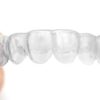 Consider Invisalign for your Orthodontic Treatment